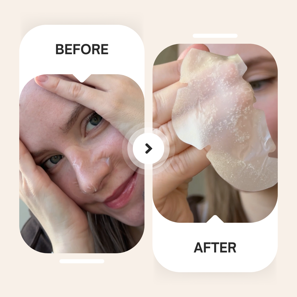 XL Hydrocolloid Nose Patch – Overnight Pore Care
