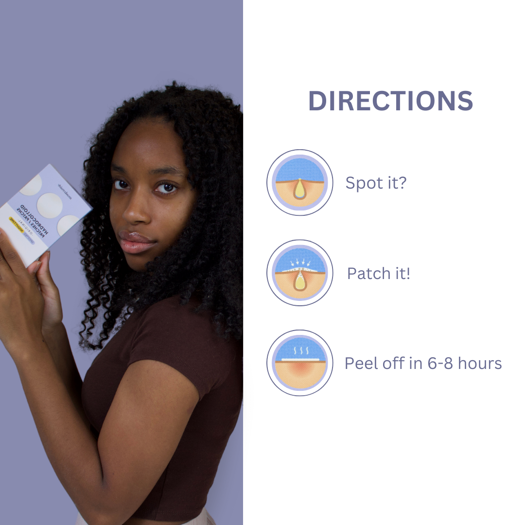 Hydrocolloid Acne Patches – Overnight Blemish Treatment