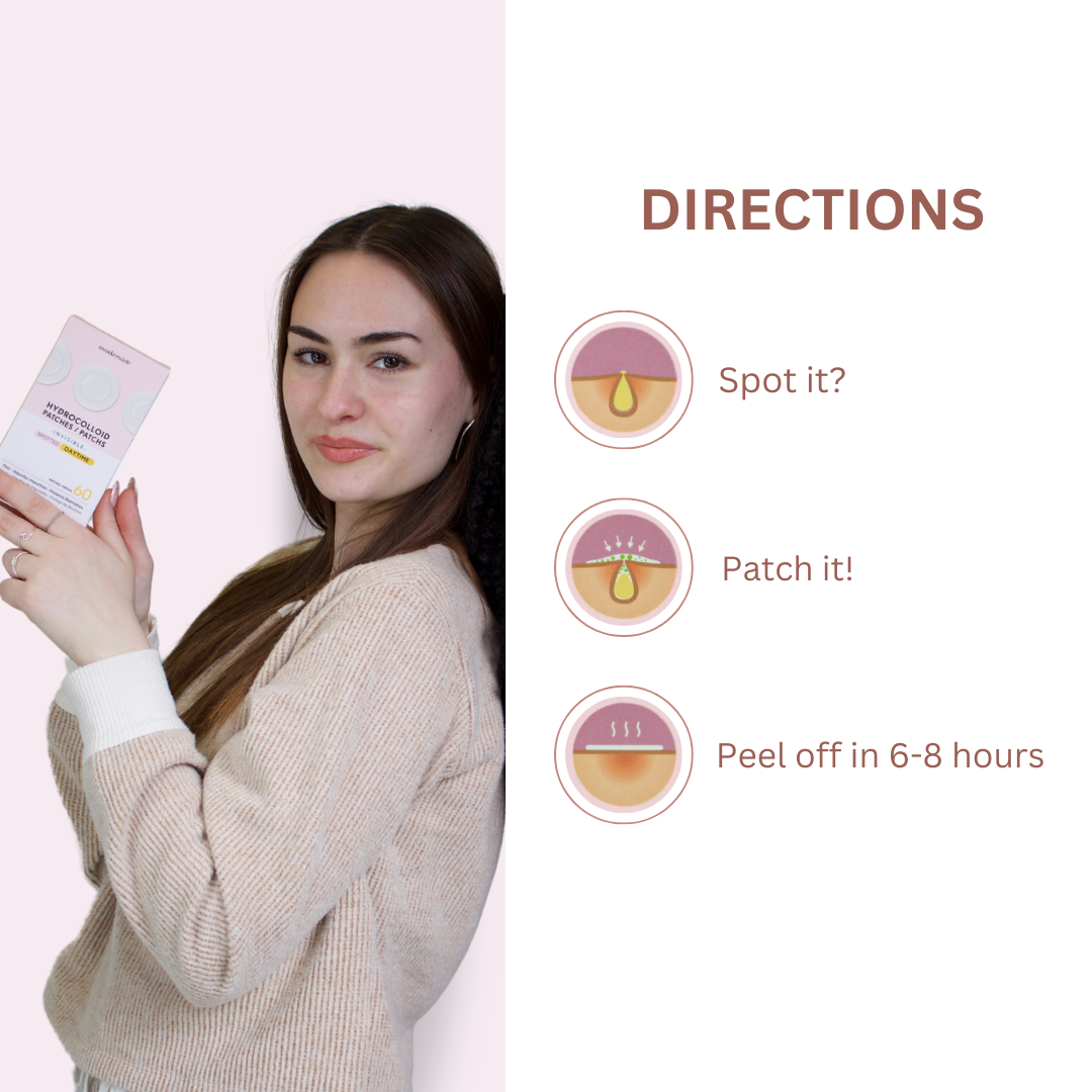 Invisible Acne Patches – Ultra-Thin Daytime Treatment